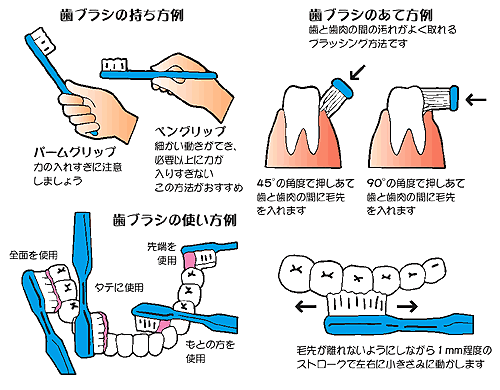 75 歯磨き 口腔 ケア 手順 イラスト 全イラスト集